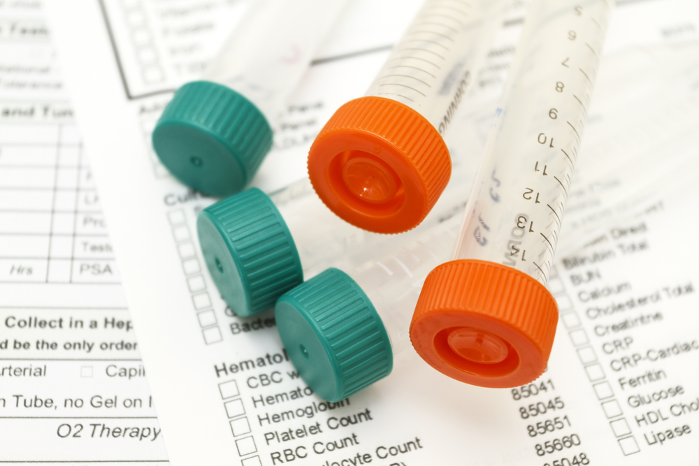 Drug and alcohol testing methodologies TSS Safety